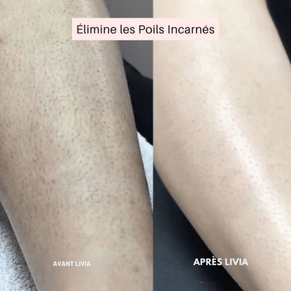LIVIA KLYNE™ – L'Excellence du Rasage Précision.