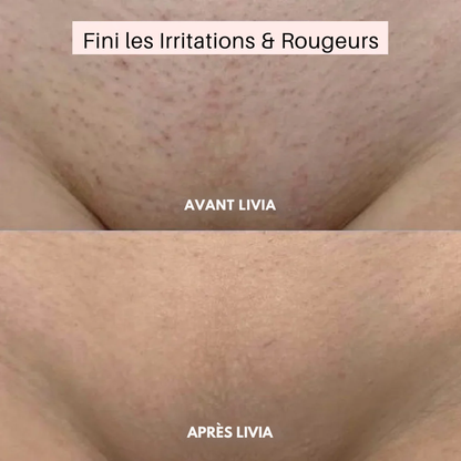 LIVIA KLYNE™ – L'Excellence du Rasage Précision.